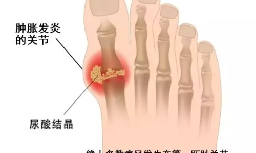 血液取回后病人外出注意事项-血液取回后病人外出网 :分享血液取回后不得再退回-血液取回后病人外出注意事项知识